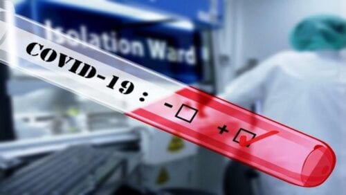Δωρεάν test Covid-19 σε όλο τον Δήμο Έδεσσας